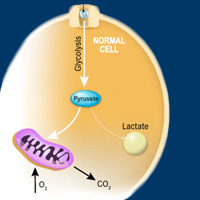 Novel Agents Aimed at Disrupting Cancer Metabolism Gain Ground